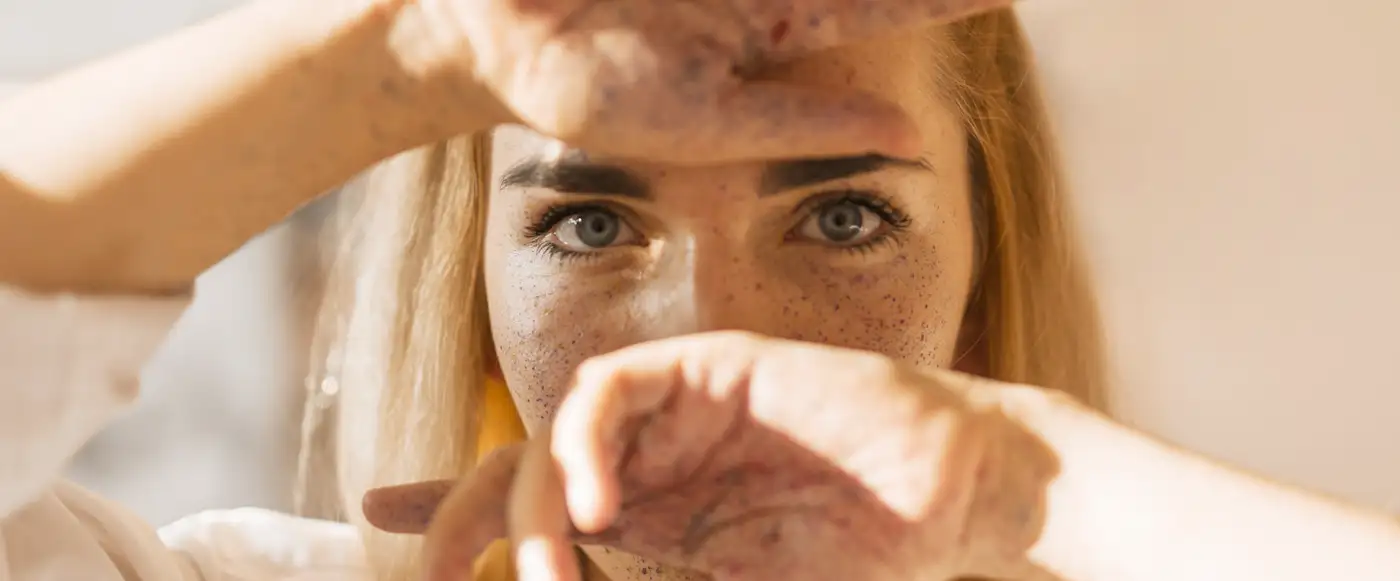 savon à la nigelle bienfiats pour la peau