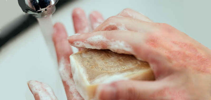 Soulager le psoriasis avec le savon d'Alep